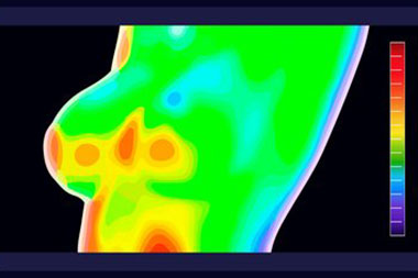 Eagle breast thermography options in ID near 83616
