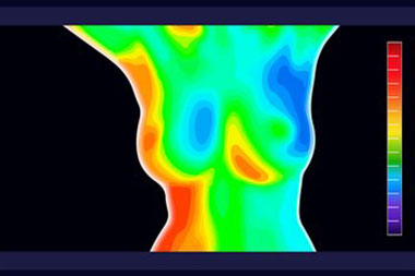 Meridian thermography screening techniques in ID near 83642