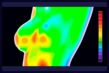 Caldwell infrared imaging for early detection in ID near 83605