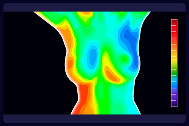 Caldwell thermogram for breast cancer screening in ID near 83605